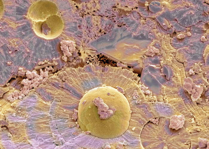 adjusting data parameters to improve result reporting and workflow