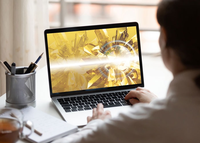 Urinary Cast and Crystals