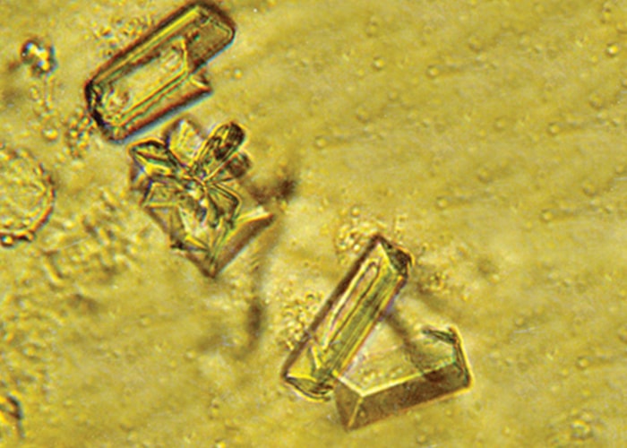 Comparing automated microscopy