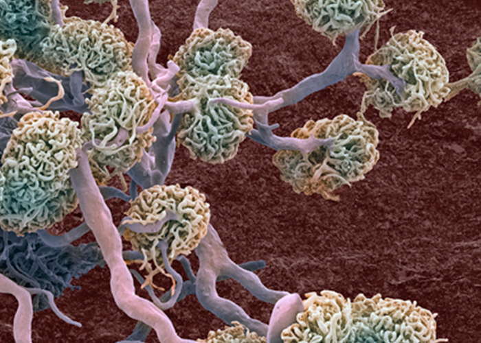 Red Blood Cell Data Correlation Between Urinalysis Methods