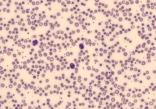Mean Sphered Cell Volume 