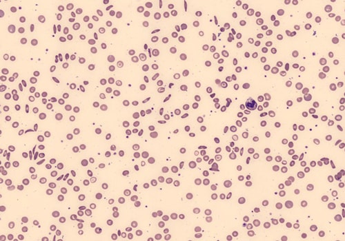 Unghosted Red Cells 