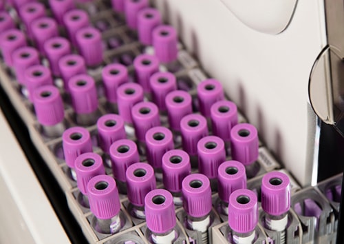 DxH 900 output buffer with cassettes purple tubes