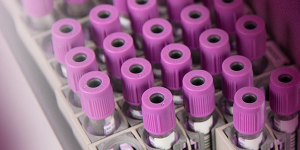 Purple hematology test tubes DxH 900 Hematology Analyzer