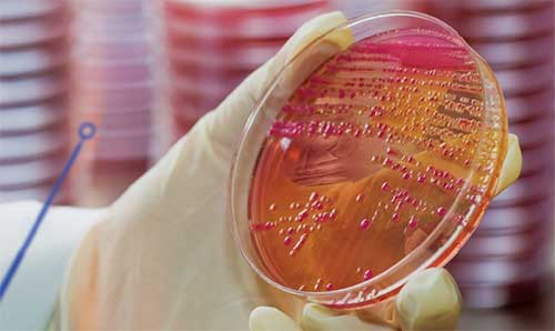 Microbiology bacteria culture Microbiology bacteria culture