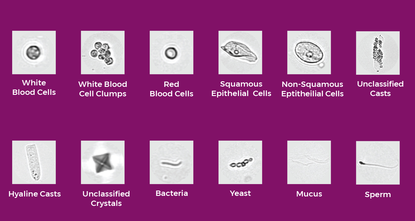 DxU-Iris-Standard-Particle-Classification